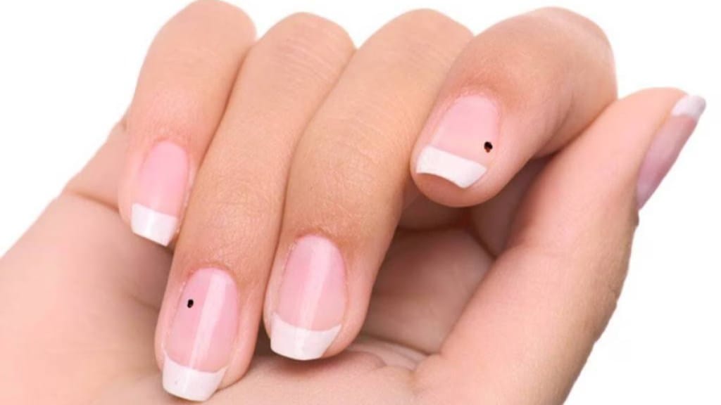 meaning of the mole on nails