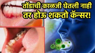 तोंडाचा कॅन्सर झाला तर आधीच दिसतात ‘ही’ लक्षणं; दातांमध्ये कीड, तोंडातून दुर्गंधी आणि…