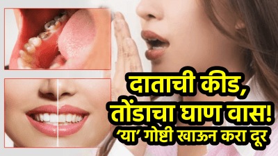 दाताला कीड लागलीय, तोंडातून घाण वासही येतो? लगेच या ५ गोष्टी खा, दात होतील चकाचक