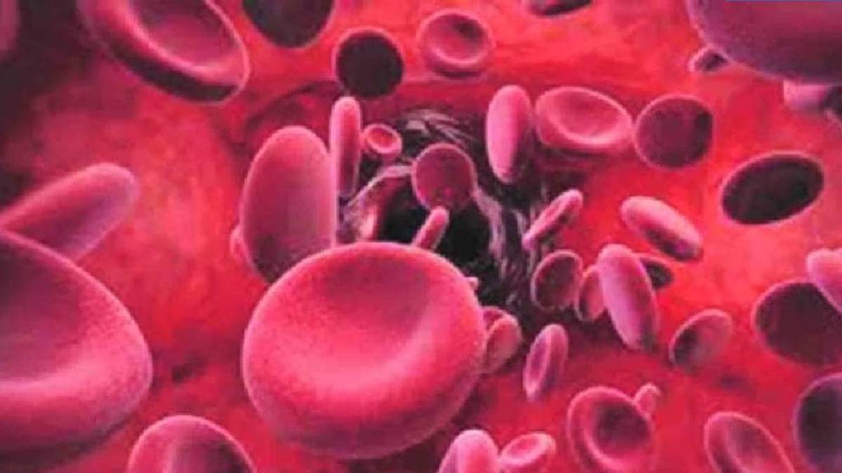 6 crore citizens screened for sickle cell disease under the National ...