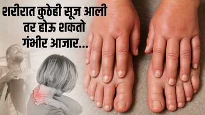 शरीरावर कुठेही सूज आली तर करताय दुर्लक्ष? मग सावधान! होऊ शकतात ‘हे’ ४ गंभीर आजार
