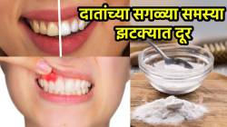 दात पिवळे झालेत? हिरड्यांमधून रक्त येतंय? मग डॉक्टरांनी सांगितलेल्या ‘या’ ४ गोष्टी लगेच करा, दातांमधील घाणही होईल साफ