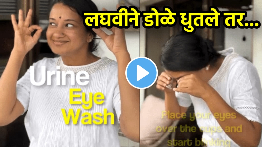 eye wash with urine in the morning is good or bad doctor advice eye care tips eye redness treatment eye infection