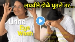 स्वत:च्या लघवीने सकाळी डोळे धुतले तर काय परिणाम होतो? डॉक्टरांनी सांगितली आश्चर्यकारक माहिती; म्हणाल्या, “आजकाल लोकांना…”