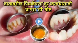 VIDEO: दातावरील पिवळेपणा ‘असा’ करा गायब! २ मिनिटात करा हळदीचा ‘हा’ सोपा उपाय, किडलेले दातही होतील पांढरे शुभ्र