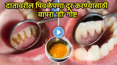 दातावरील पिवळेपणा असा करा गायब! २ मिनिटात करा हळदीचा हा सोपा उपाय, दात होतील पांढरे शुभ्र