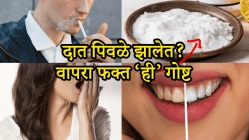 सिगारेट, तंबाखूमुळे दात पिवळे झालेत? तोंडातून दुर्गंधीही येतेय? मग डॉक्टरांनी सांगितलेल्या ‘या’ ४ गोष्टी करून पाहाच, सफेद होतील दात