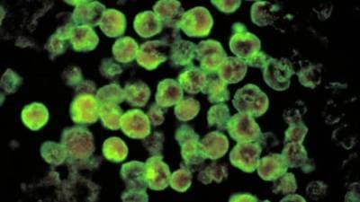 केरळमध्ये ‘ब्रेन इटिंग अमीबा’ खातोय आयुष्य; नेमका काय आहे हा आजार?