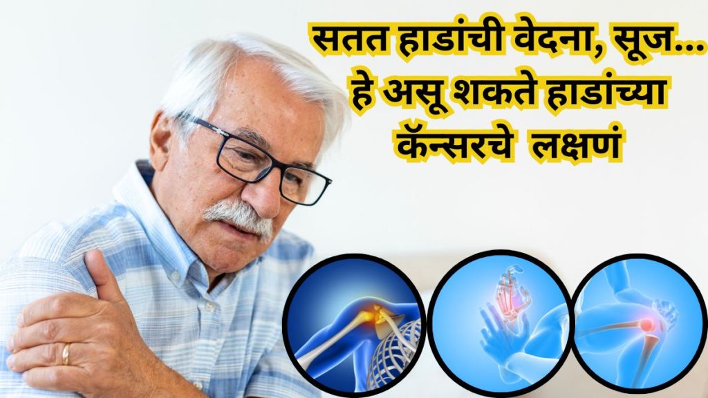 Bone loss is not just a result of aging it can also be a sign of cancer