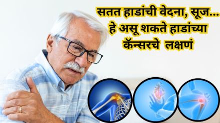 Bone loss is not just a result of aging it can also be a sign of cancer