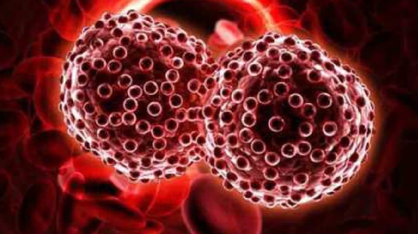 Stomach cancer symptoms
