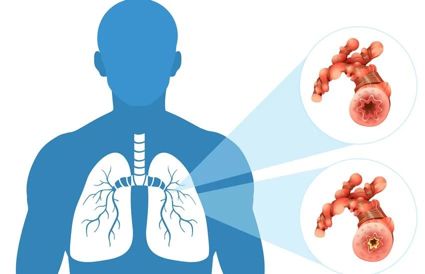 easiest way to cleanse lungs naturally without medicine