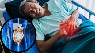 Colon Cancer Warning Signs