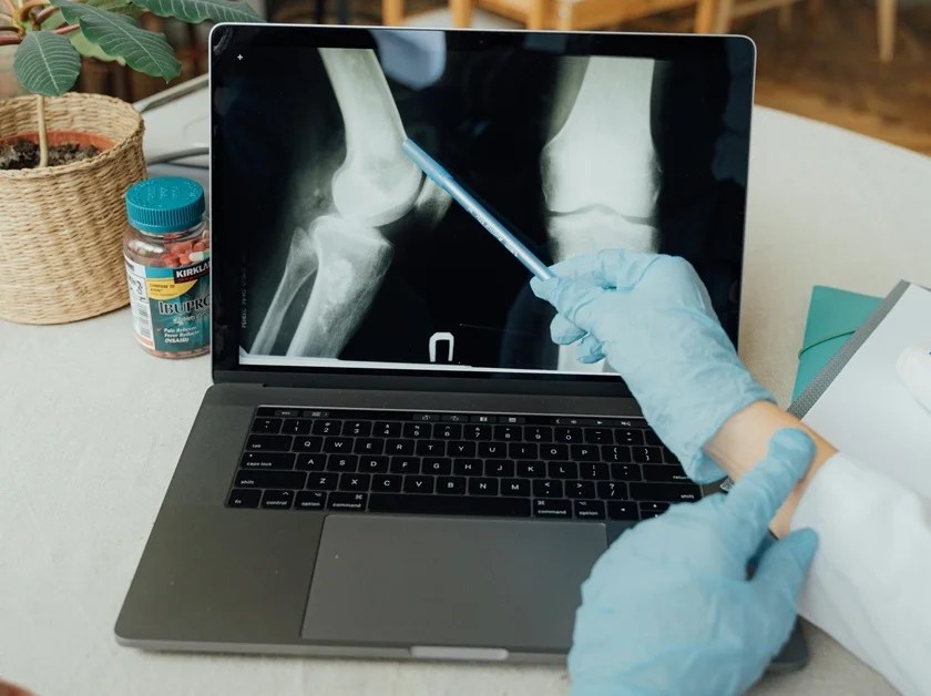 bone cancer symptoms, early signs of bone cancer