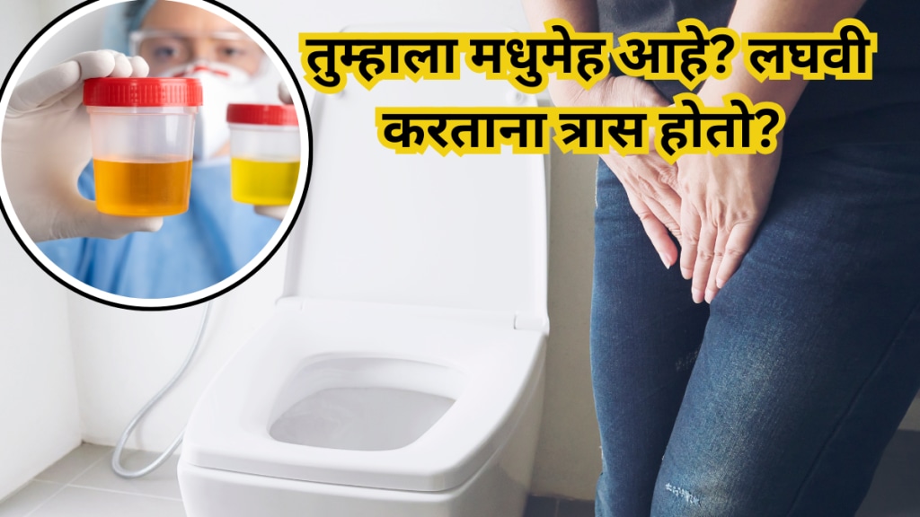 Do you have diabetes Do you have difficulty urinating