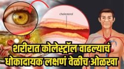 खराब कोलेस्ट्रॉल वाढल्यास शरीर-चेहऱ्यावर दिसतात ‘ही’ ६ भयंकर लक्षणे, आरशात तुम्हालाही दिसतायत का ‘हे’ बदल? वेळीच ओळखा नाहीतर..