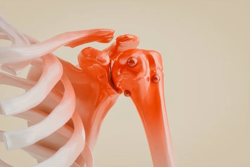bone cancer symptoms, early signs of bone cancer