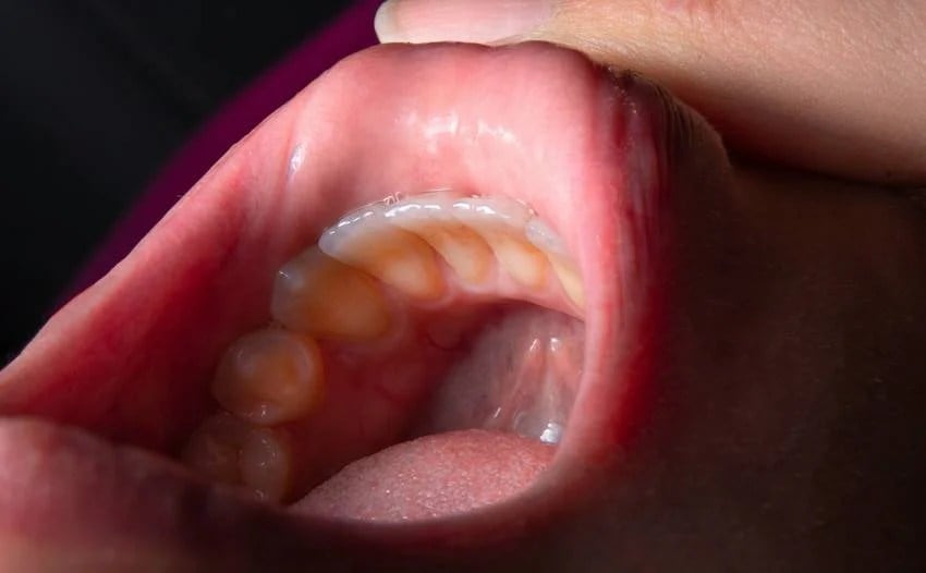 want to keep your teeth strong and shiny until old age include these 10 habits