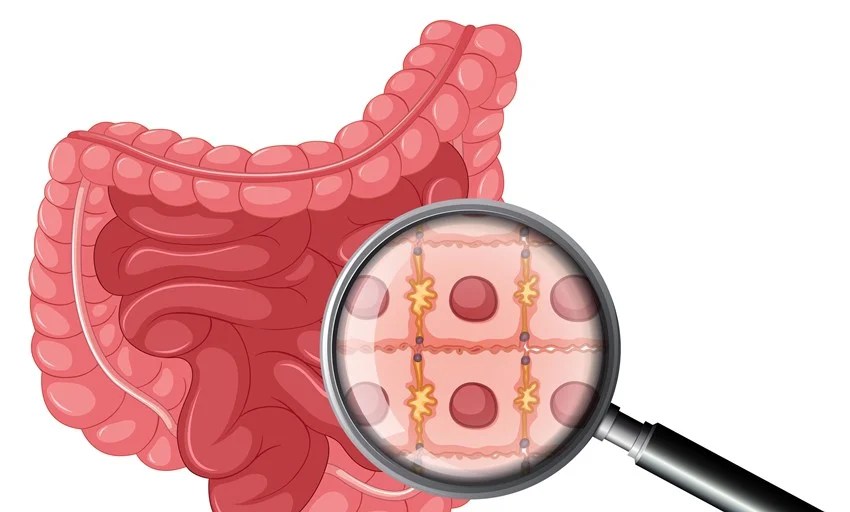 Natural ways to clean intestines