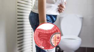 Natural ways to clean intestines