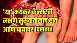 ‘या’ भयंकर कॅन्सरची लक्षणे सुरुवातीलाच हात आणि पायांवर दिसतात; दुर्लक्ष करणं जिवावर बेतू शकतं, आत्ताच जाणून घ्या