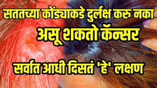 Signs of scalp cancer