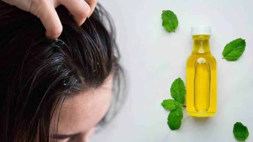 apple cider vinegar scalp treatment,