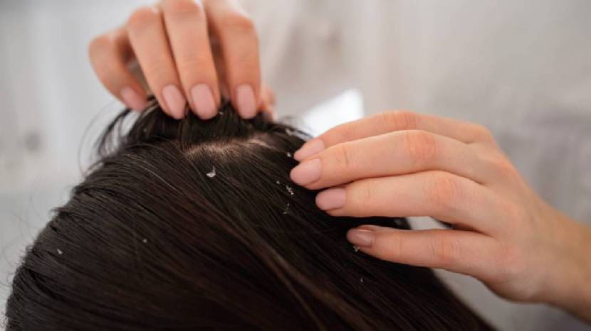 monsoon hair care tips