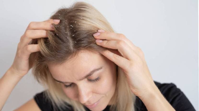  hair fall solutions monsoon
