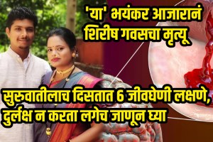 Shirish Gavas Of Red Soil Stories In Konkan Passed Away Because Brain Hemorrhage Know Symptoms