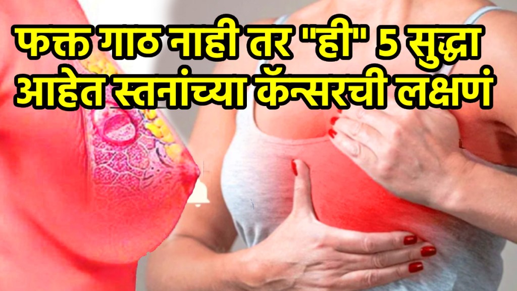 Breast Cancer Symptoms