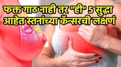 Breast Cancer: महिलांनो फक्त गाठ नाही तर “ही” ५ सुद्धा आहेत स्तनांच्या कॅन्सरच्या लक्षणे; शरीरात कुठेही दिसली तर ताबडतोब डॉक्टरांकडे जा