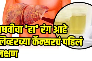 Liver cancer symptom and prevention urine can be causes of liver cancer health tips
