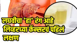 Liver Cancer: लघवीचा “हा” रंग आहे लिव्हरच्या कॅन्सरचं पहिलं लक्षण; लगेच जाणून घ्या अन्यथा दुर्लक्ष करणे ठरू शकते प्राणघातक