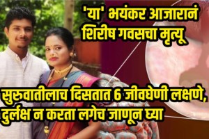 Shirish Gavas Of Red Soil Stories In Konkan Passed Away Because Brain Hemorrhage Know Symptoms