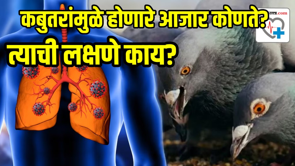 Do pigeons really pose a health risk?, How Does a Pigeon Causes Health Issues, What are the diseases caused by pigeons?
