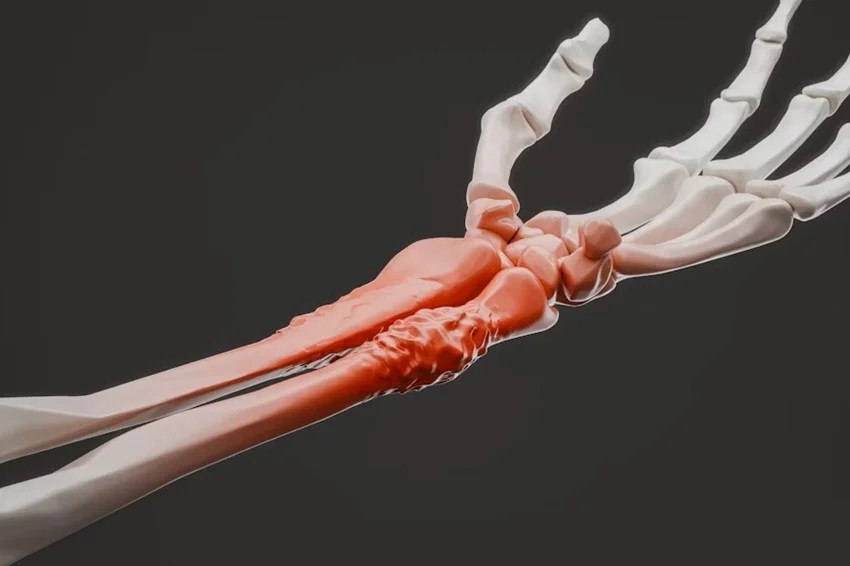 bone cancer symptoms, early signs of bone cancer
