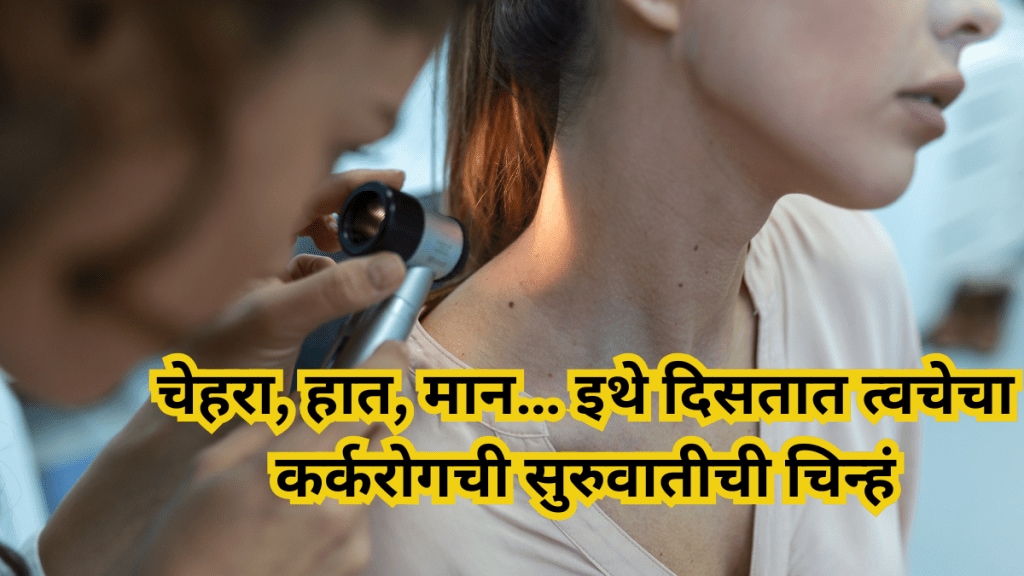 Skin Cancer