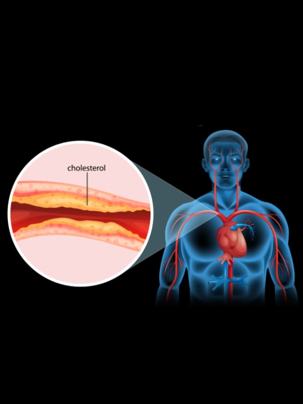 Tips To Control Cholesterol