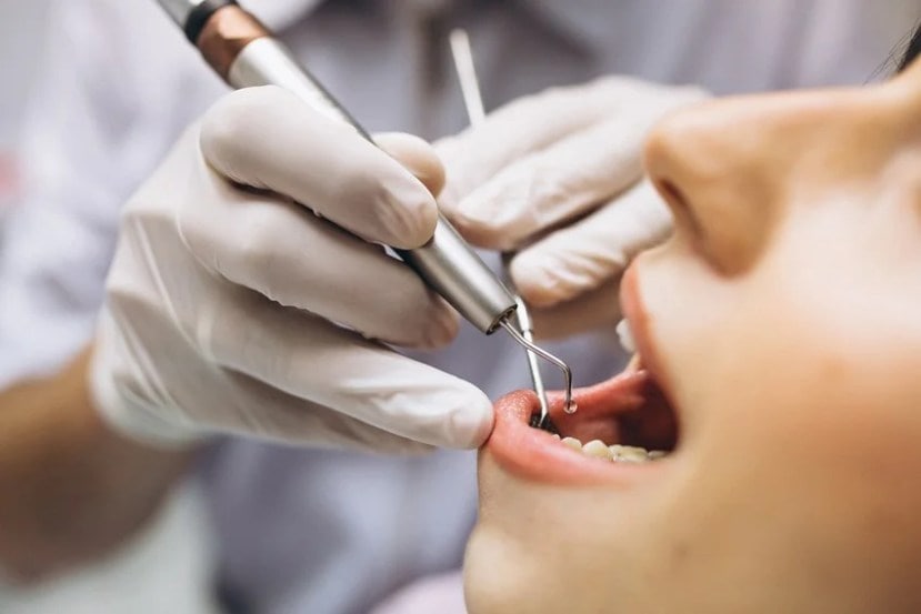 Tooth Sensitivity Ayurvedic treatment 8