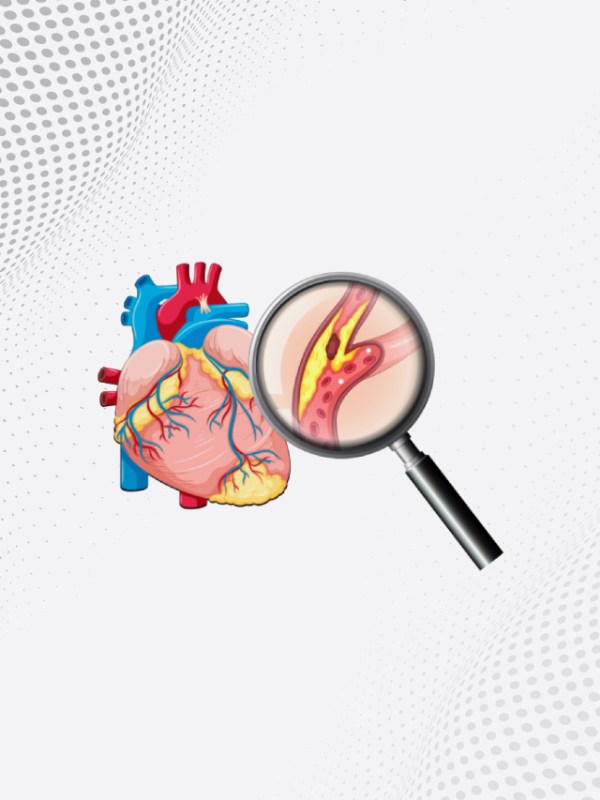 What Happens If Cholesterol Increases In Body