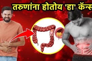 colon cancer symptoms in young people adults fruits for colon cancer causes and treatment