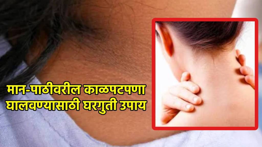 homemade cleanser to get ride of dark neck and back