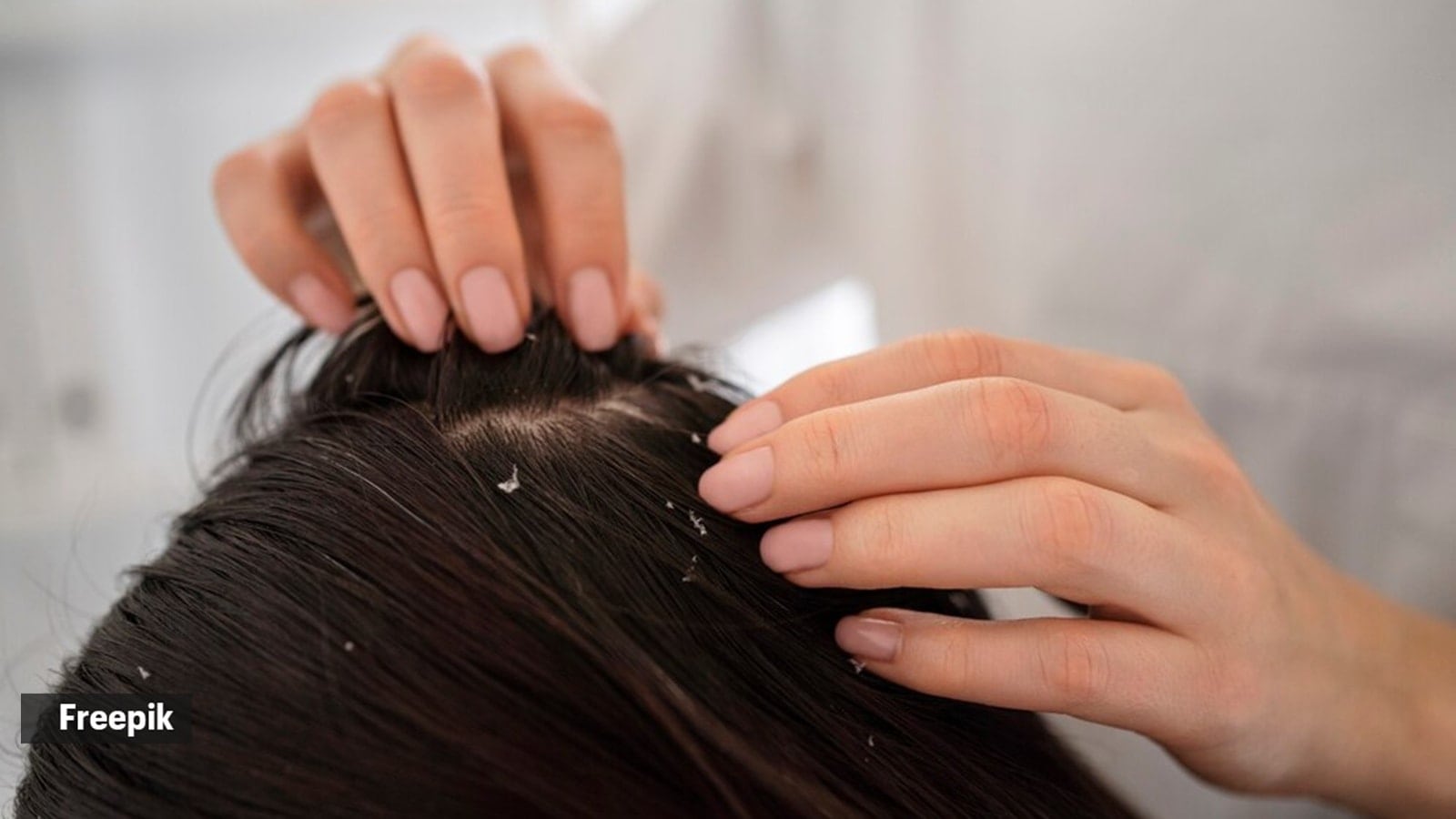 scalp