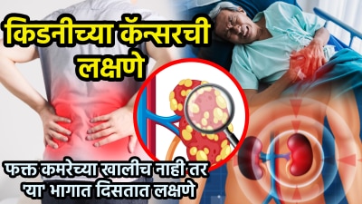 किडनीचा कॅन्सर झाला तर सुरुवातीलाच दिसतात ही लक्षणे, झपाट्याने वाढतो अन् माणसाचे हाल करतो
