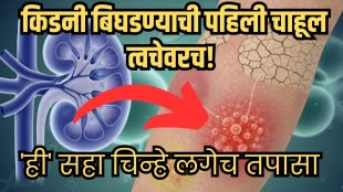 Skin Changes Kidney Disease