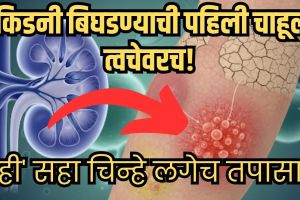 Skin Changes Kidney Disease