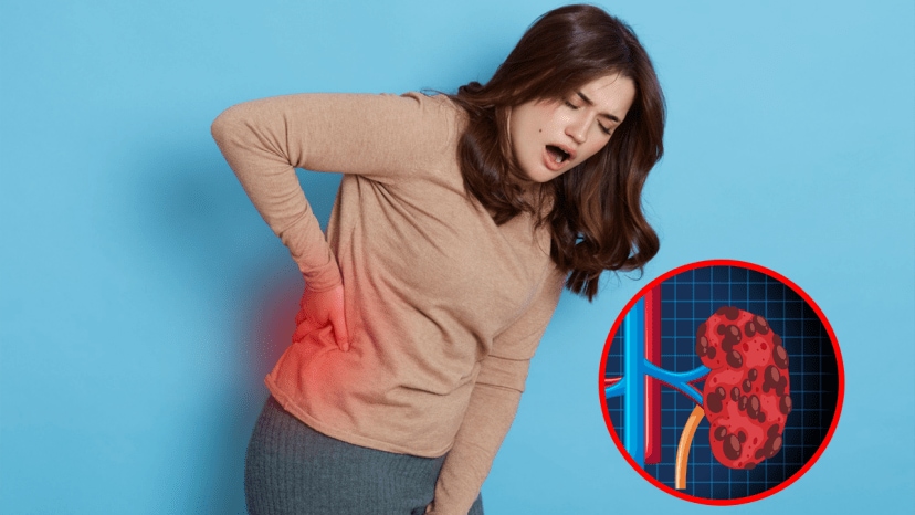 Side Flank Pain Kidney