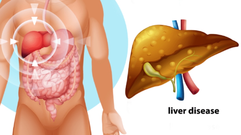 liver cancer cause