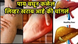 लिव्हर खराब झालं तर पायांमध्ये दिसतात ‘ही’ ६ लक्षणे! दुर्लक्ष केलं तर होतील वाईट परिणाम